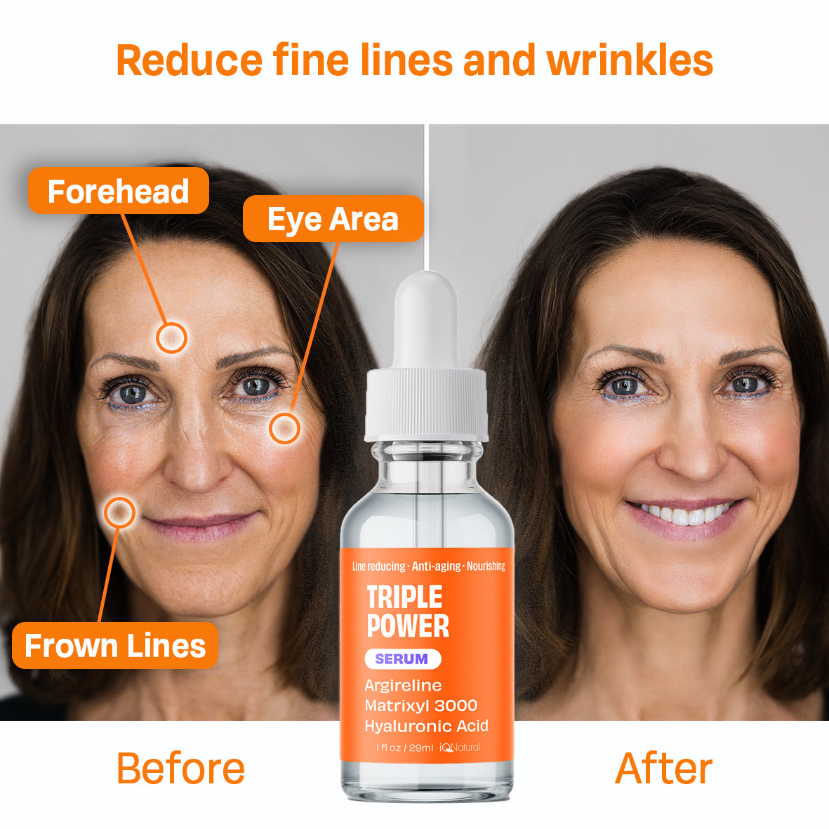 Argireline Line Reducing Serum iQ Natural