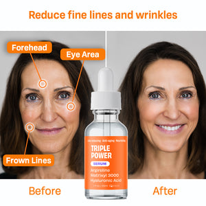 Argireline Line Reducing Serum - iQ Natural 